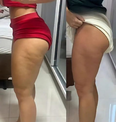 Reclaim Your Confidence and Embrace Your Beauty